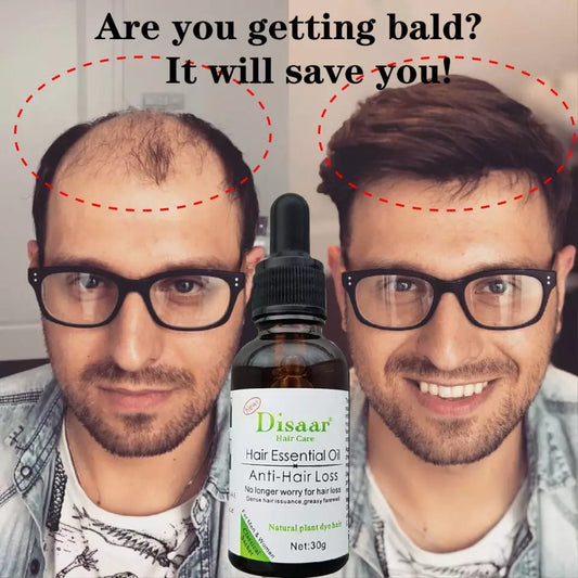 Aceite anticaída para el cabello