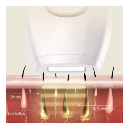 DEPILADORA LASER IPL